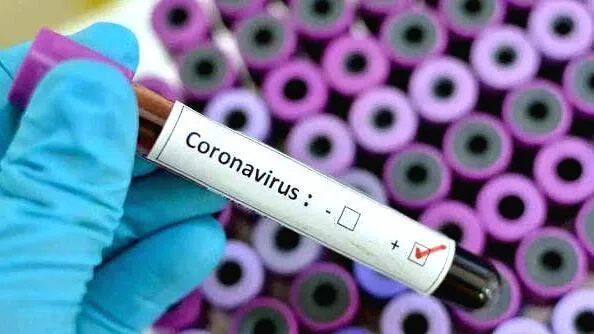 covid-test
