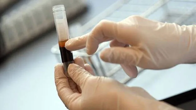 plasma-therapy