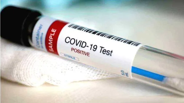 covid-test