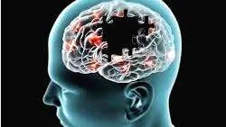 alzhimers