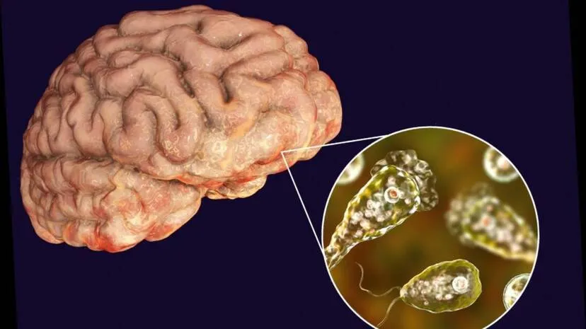 brain