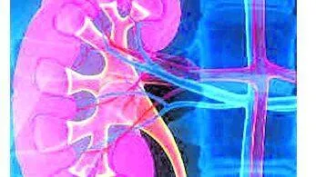 kidney