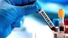 covid-test covid-test