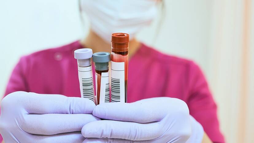 A single blood test can detect more than fifty cancers – LIFESTYLE – HEALTH
