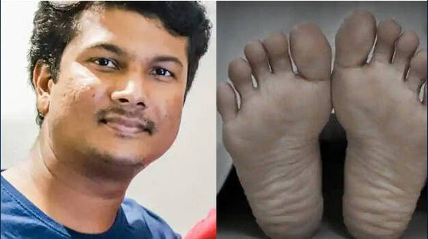 accident-death accident-death