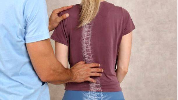 scoliosis- scoliosis-