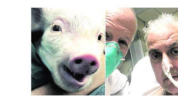 pig-transplant