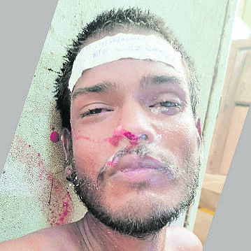 unkn-person-death-phot unkn-person-death-phot