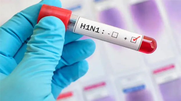 h1n1