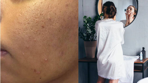 beauty-tips beauty-tips