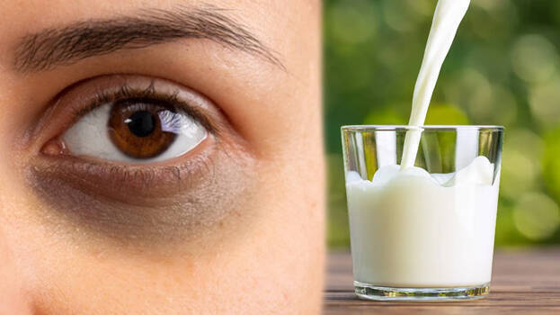 under-eye-dark under-eye-dark