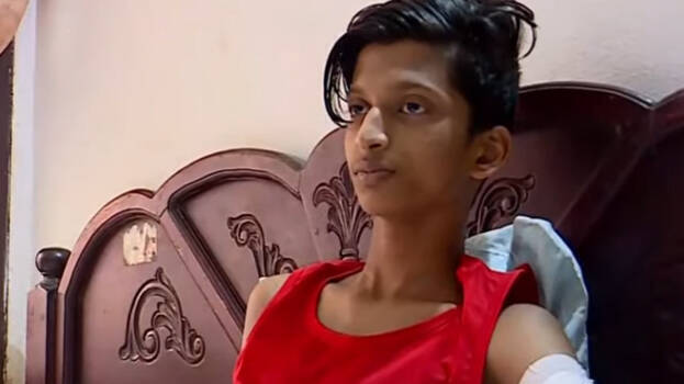 hand-amputated- hand-amputated-