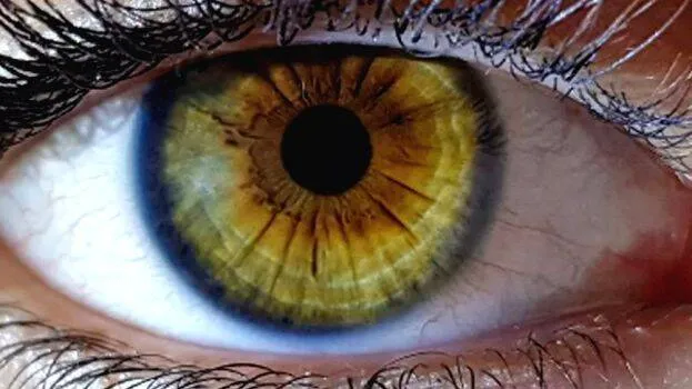 eye