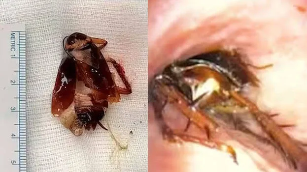 cockroach