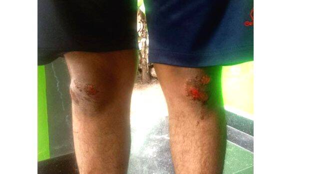 dog-attack dog-attack