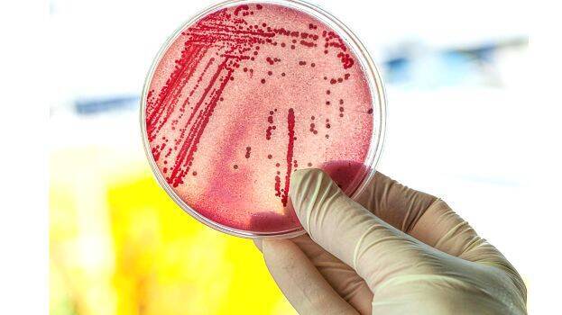 coliform-bacteria