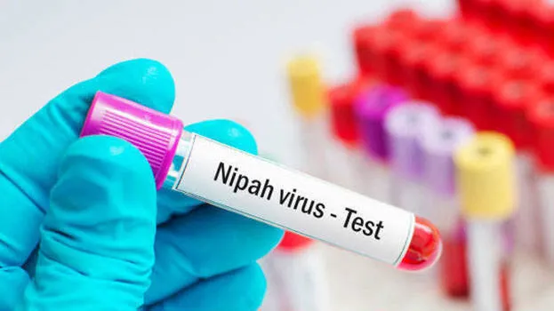 nipah-virus