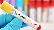 nipah-virus