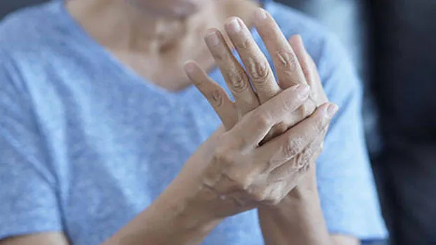 arthritis
