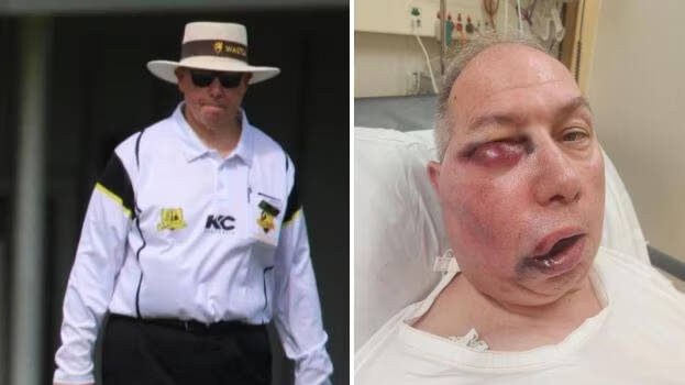 umpire-accident umpire-accident