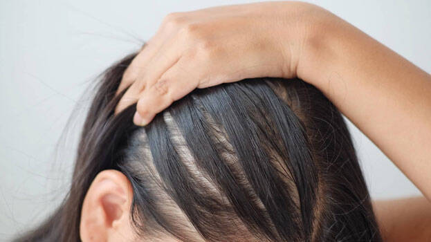 hair-greying hair-greying