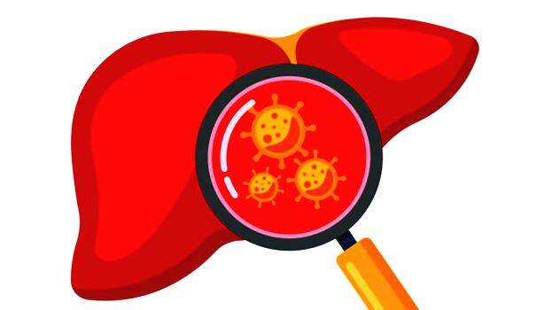 hepatiitis hepatiitis