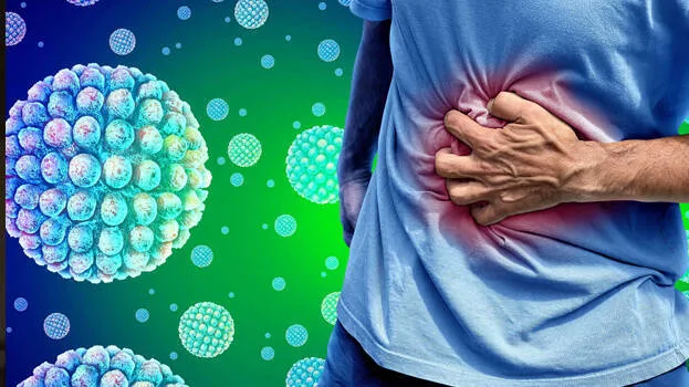 norovirus