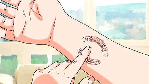 bite bite