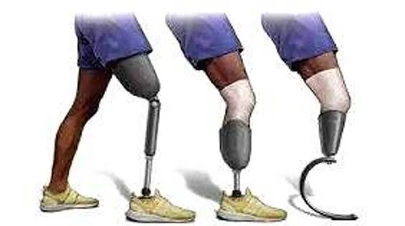 leg