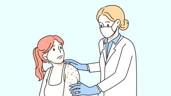 chickenpox