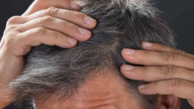 grey-hair