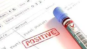 hiv