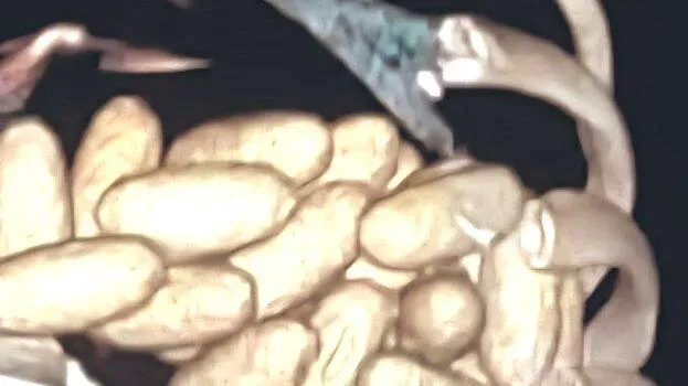 d