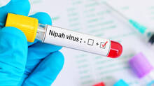nipah-girl-dies-in-kozhikode
