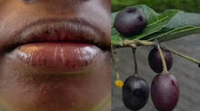 school-student-fell-ill-after-eating-a-fruit-similar-to-jamun-fruit