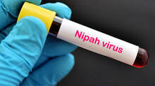 nipah-virus-search-for-interstate-worker-who-includes-in-contact-list