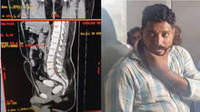 man-arrested-for-hiding-mdma-in-body-at-kollam