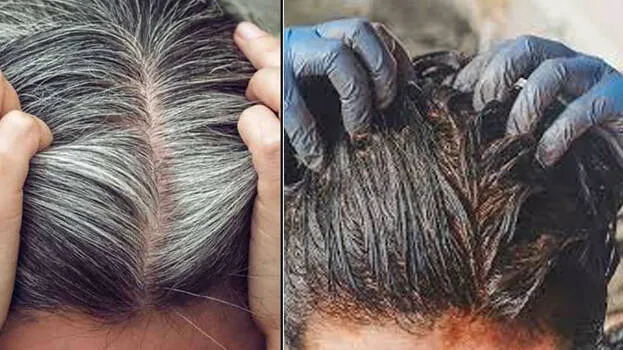 hair