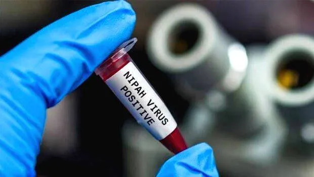 nipah-virus
