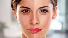 anti-ageing
