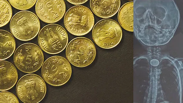 coins