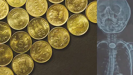 coins