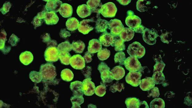 amoeba