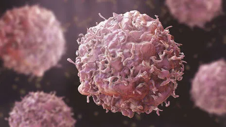 cancer