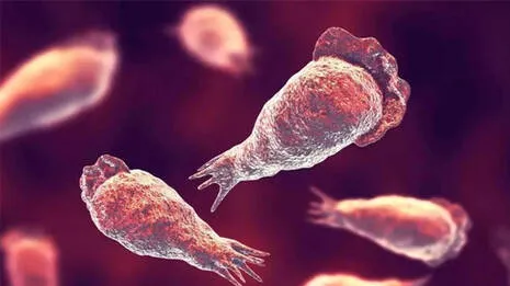 encephalitis