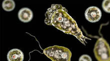 amoebic-meningoencephalitis-test-positive