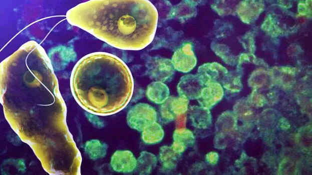 amoebic-meningoencephalit