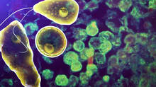 amoebic-meningoencephalitis-case-in-kozhikkode