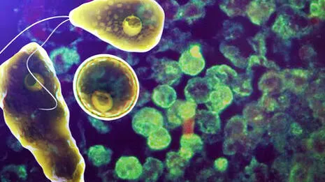 amoebic-meningoencephalit
