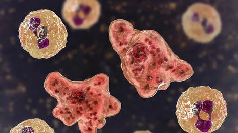 amoebic-meningoencephalit